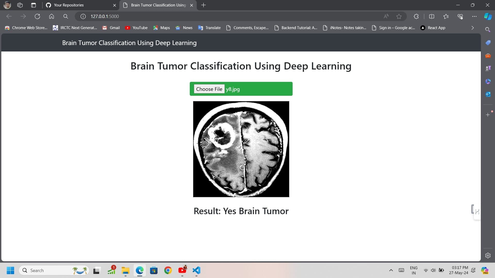 Brain-Tumor Classification using CNN